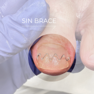SinBrace cursus