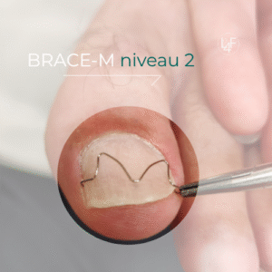 Brace-M  | Cursus Niveau 2